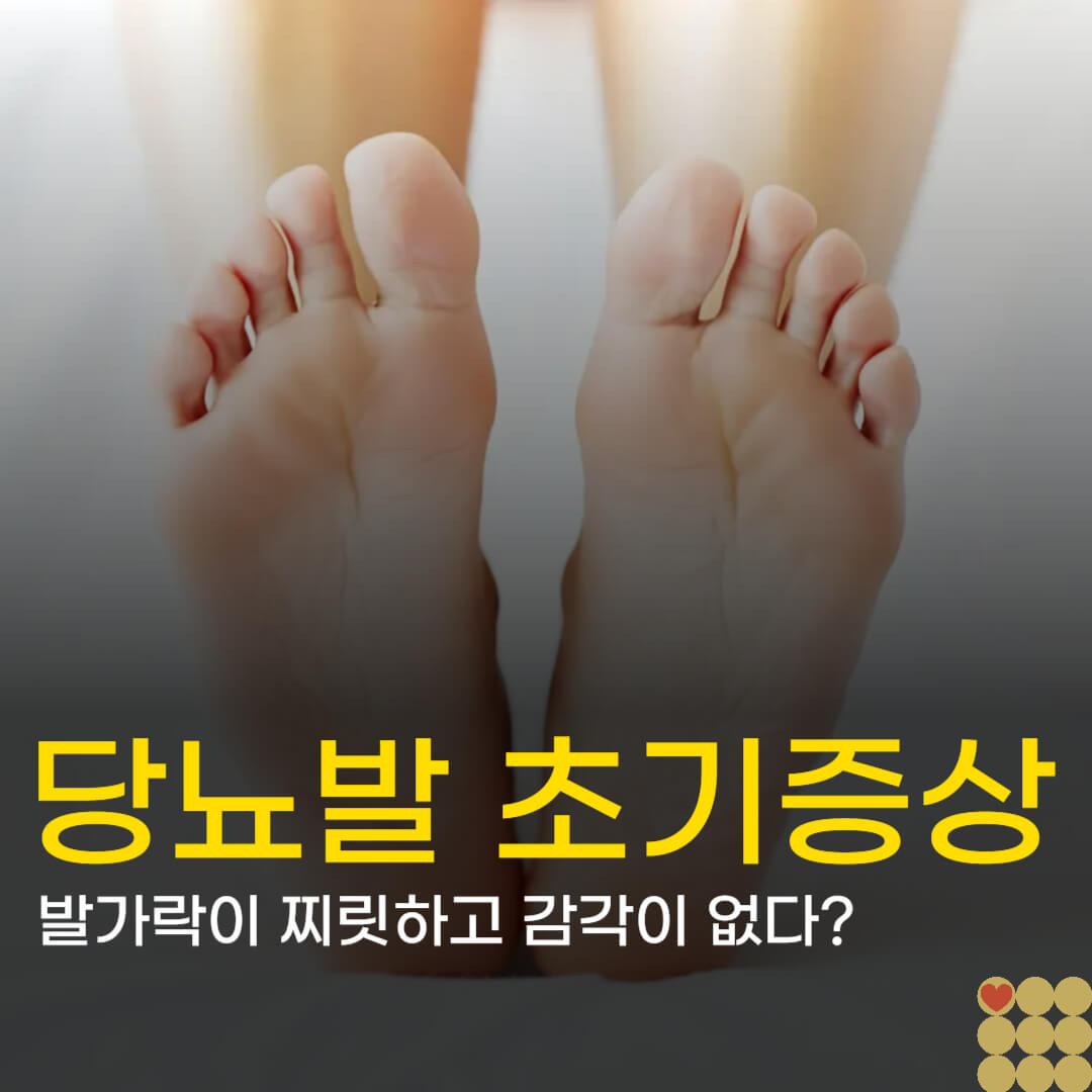발가락이 찌릿하고 감각이 없다면? '당뇨발' 초기 증상과 매일 하는 발 관리법