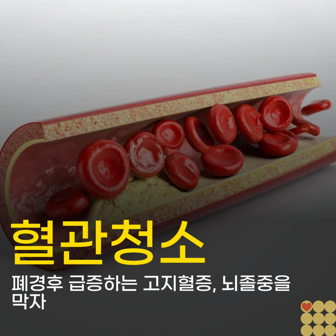 폐경 후 급증하는 고지혈증: 겨울철 뇌졸중(중풍)을 막는 '혈관 청소' 음식 5가지