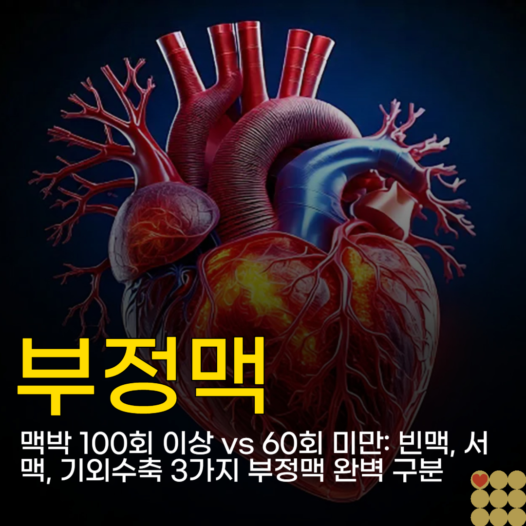 맥박 100회 이상 vs 60회 미만: 빈맥, 서맥, 기외수축 3가지 부정맥 완벽 구분
