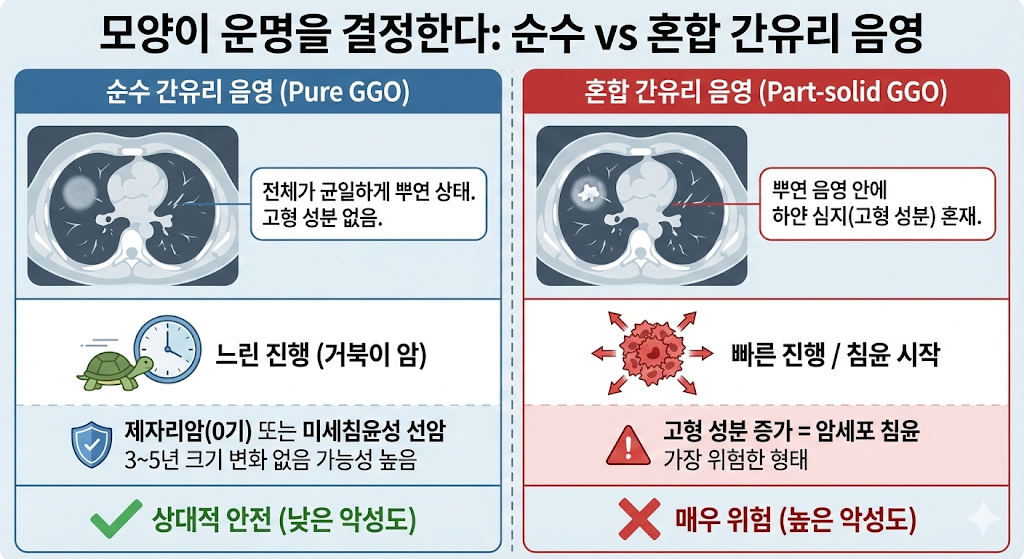 폐암의 씨앗 '간유리 음영', 3년 추적 관찰 중 5mm 커지면 암일까? 3 image 23