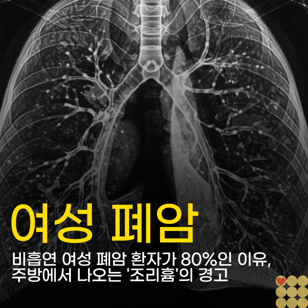 비흡연 여성 폐암 환자가 80%인 이유, 주방에서 나오는 '조리흄'의 경고