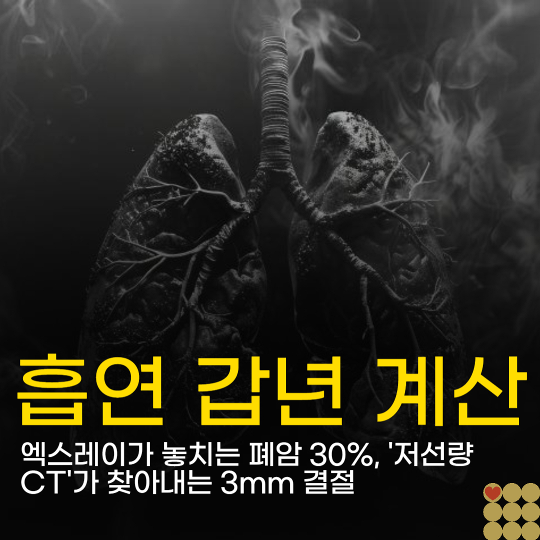 엑스레이가 놓치는 폐암 30%, '저선량 CT'가 찾아내는 3mm 결절
