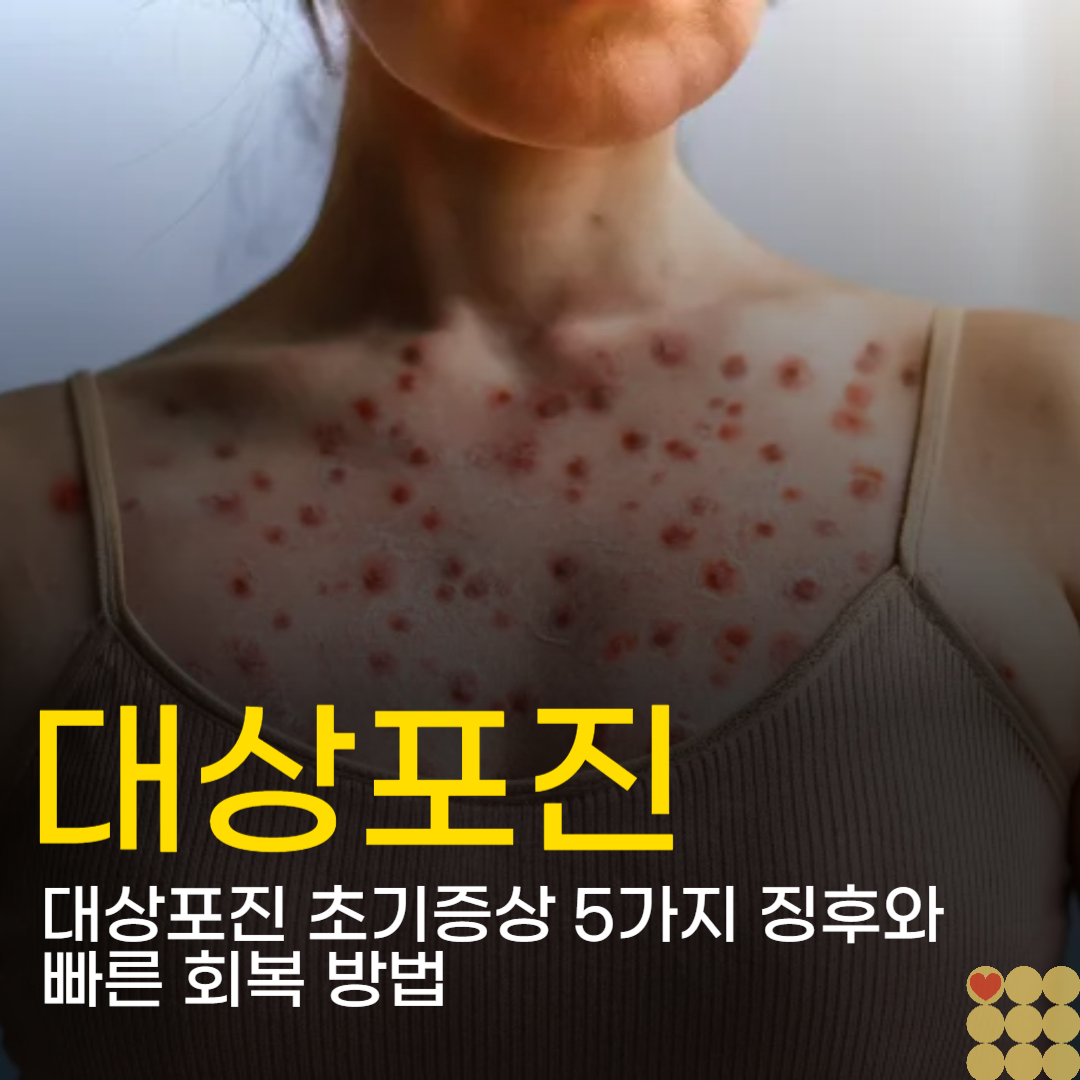 대상포진 초기증상 5가지 징후와 빠른 회복 방법